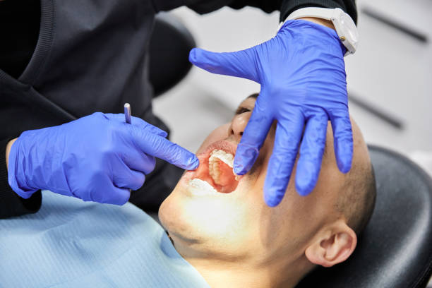 Best Emergency Wisdom Teeth Removal in Comstock Park, MI